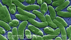 В Испании закрывают пляжи из-за плотоядной бактерии Vibrio