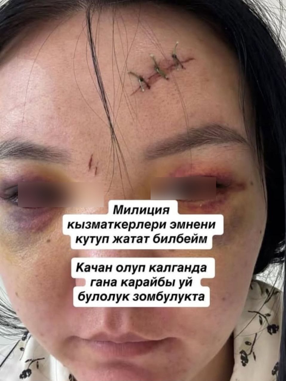 «Мне нужно умереть?» Избитая мужем женщина оспаривает экспертизу